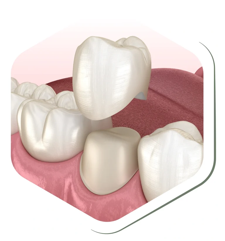 durable affordable solutions restore missing broken teeth