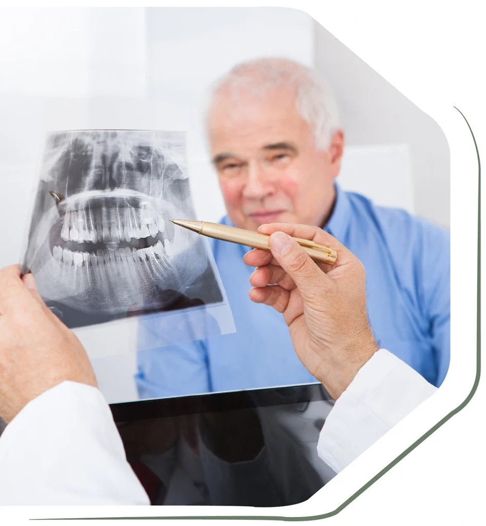 x-ray-before-dental-implants