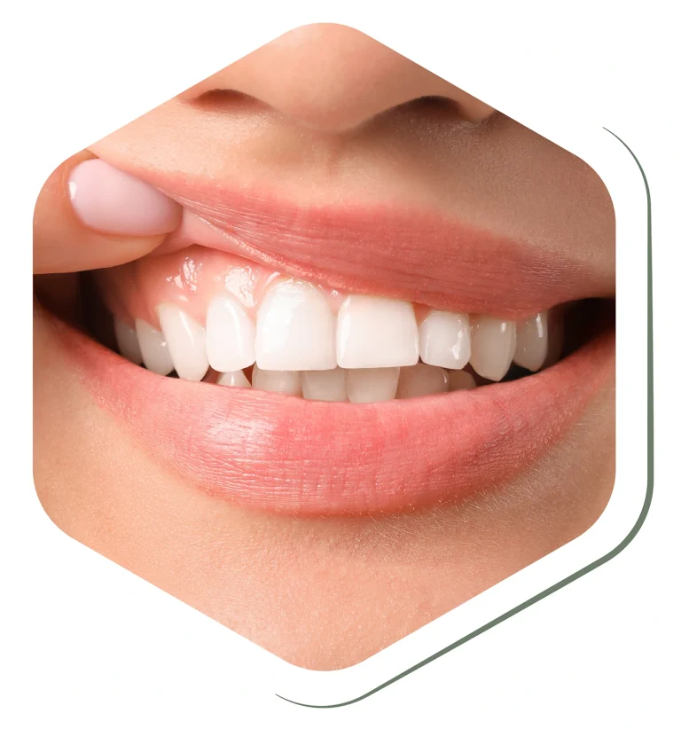 gum health oral