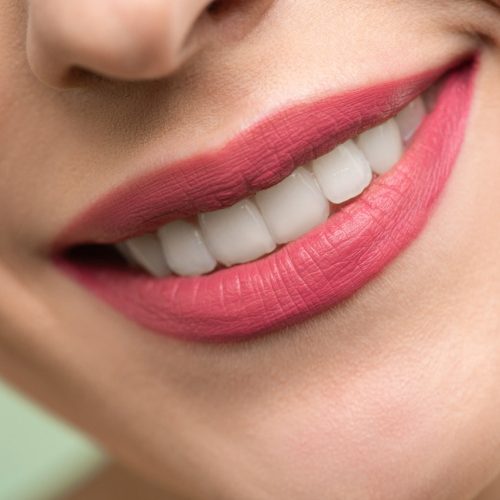 woman smiling showing teeth