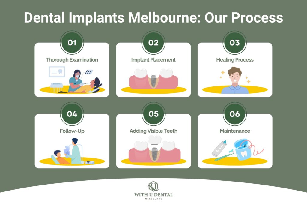 dental implants procedure in melbourne